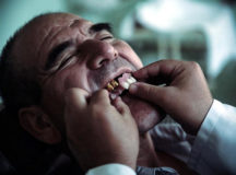 Россияне все чаще сдают зубы в ломбард. © Фото с сайта lenta.ru