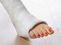 Белоруска уговорила друга сломать ей ногу ради страховки. © Фото с сайта kristof-blog.ru