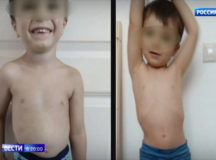 Родион Голубков до и после веганской диеты. © Скриншот из видео