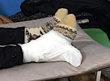 В российской больнице перелом бедра "вылечили" шваброй. © Фото - Альфия Гумирова