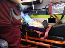 Пострадавший школьник. © Фото МЧС Беларуси